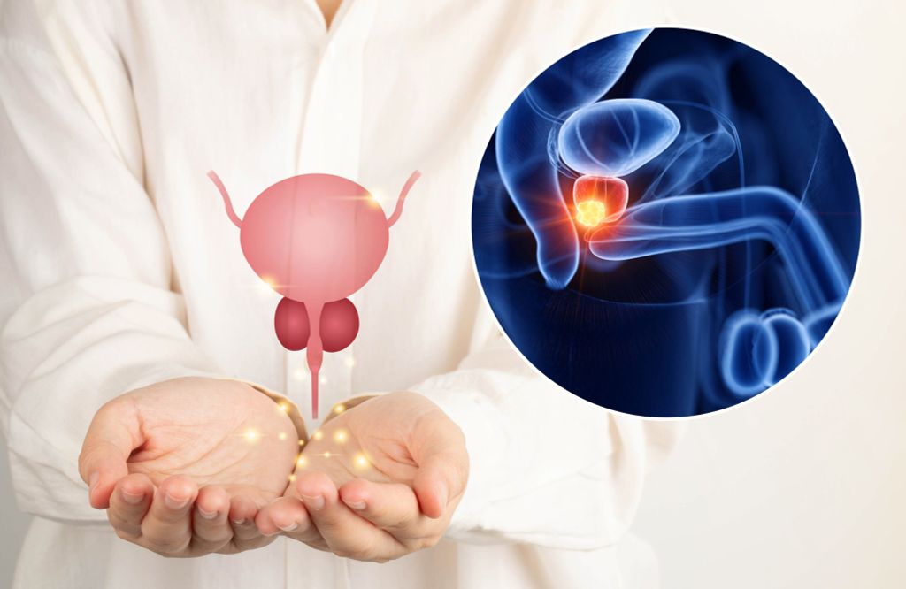 Zoladex (Goserelin) - Giải Pháp Hiệu Quả trong Điều Trị Ung Thư Tiền Liệt Tuyến và Ung Thư Vú