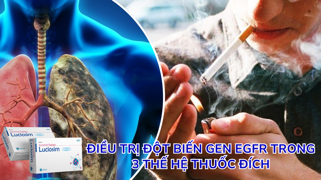 ĐỘT BIẾN GEN EGFR. TRONG 3 THẾ HỆ THUỐC ĐÍCH, NÊN CHỌN THUỐC NÀO LÀM ĐIỀU TRỊ BƯỚC ĐẦU?
