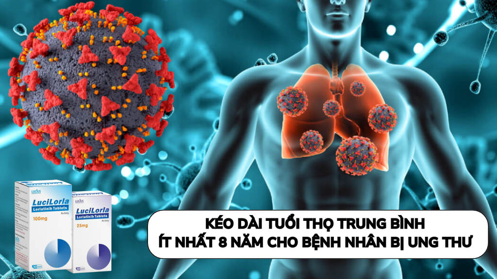 Thuốc Đích: Góp Phần kéo dài Tuổi Thọ Trung Bình 8 Năm cho Bệnh Nhân Ung Thư Phổi Giai Đoạn Cuối