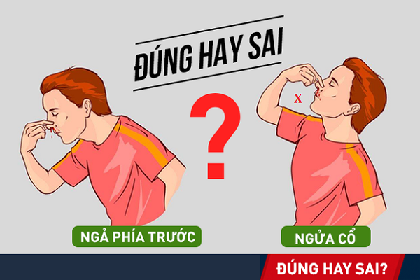 Những sai lầm trong sơ cứu khi chảy máu cam