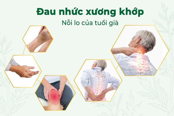 Đau nhức xương khớp nỗi lo của tuổi già: Bí quyết đơn giản, hiệu quả ngay tại nhà mà ít ai biết đến ?