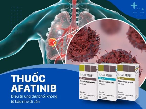 AFATINIB: Giải Pháp Mới Cho Ung Thư Phổi Biểu Mô Tế Bào Vảy