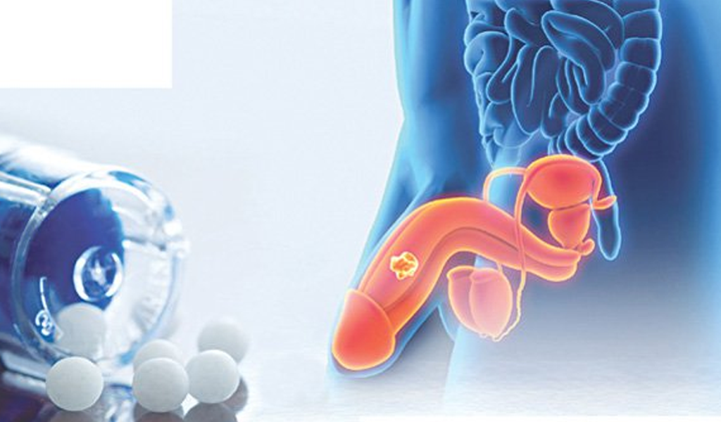 Ung thư dương vật: nguyên nhân, triệu chứng và cách điều trị